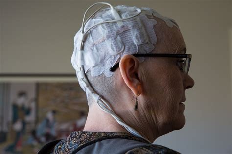 Electrical Scalp Device Can Slow Progression Of Deadly Brain Tumors