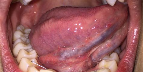 Simple Science: How to Make a Volcano with Kids