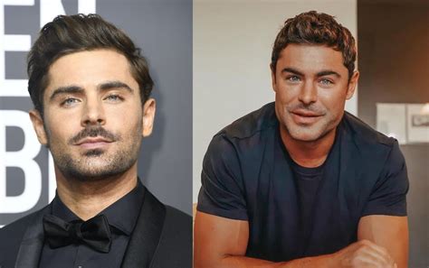 Zac Efron Before And After Did He Get Plastic Surgery