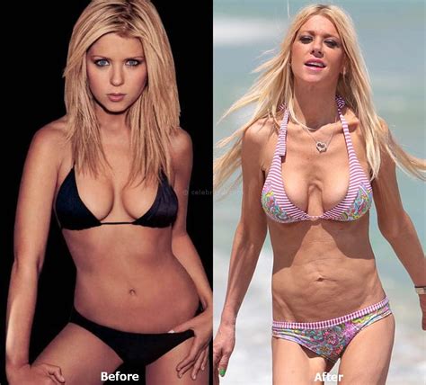 Tara Reid Plastic Surgery Gone Bad Before And After Pics