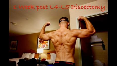 1 Week Post L4 L5 Discectomy Youtube