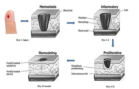 Phases Of Wound Healing