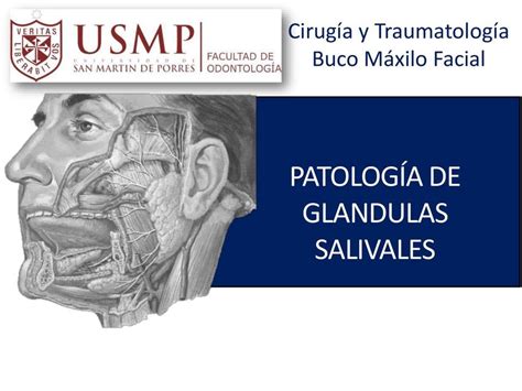 Patologia De Glandulas Salivales Douglass Drddouglass85 Udocz