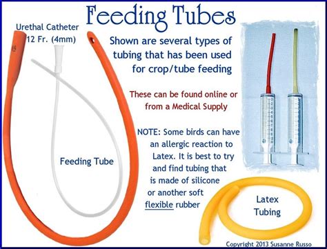 Tube Feeding Supplies And Where To Get Them