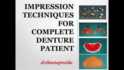 Impression Techniques For Complete Denture Patient Youtube