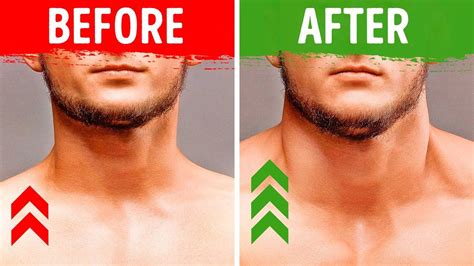 7 Exercises For Men To Build A Big Strong Neck Youtube Neck Muscle