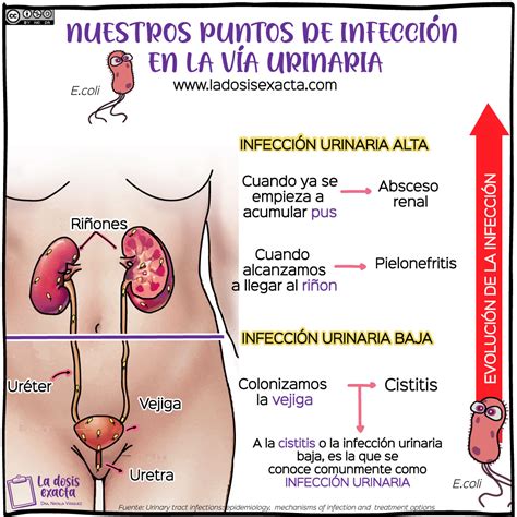 Infecci N Urinaria En La Mujer S Ntomas Tratamiento Y Prevenci N Dra Natalia V Squez