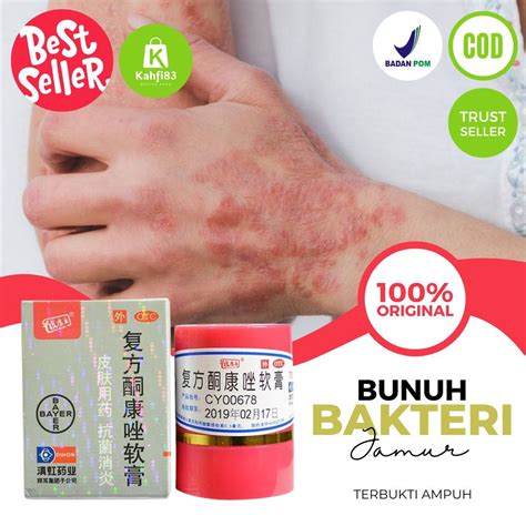 Jual Pi Kang Wang Obat Panu Paling Ampuh 100 Salep Cream Obat Panu