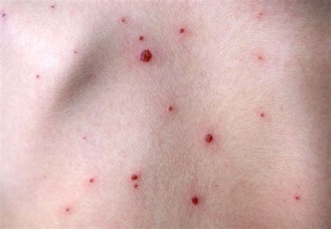 A basic skin rash can take for example, take a look at the two different pictures of skin rash below. Pictures of Skin Infections