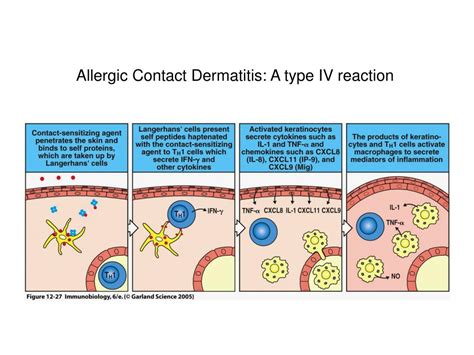 Ppt Allergy And Hypersensitivity Powerpoint Presentation Free