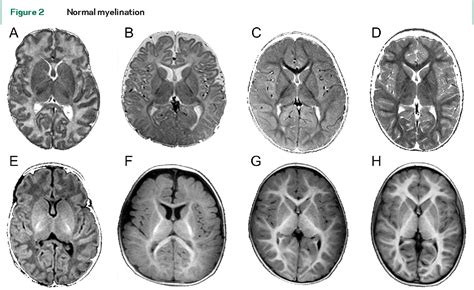 Figure 2 From Invited Article An Mri Based Approach To The Diagnosis
