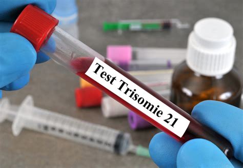 News Bluttest Kann Trisomie Zuverl Ssig Bestimmen Ethische