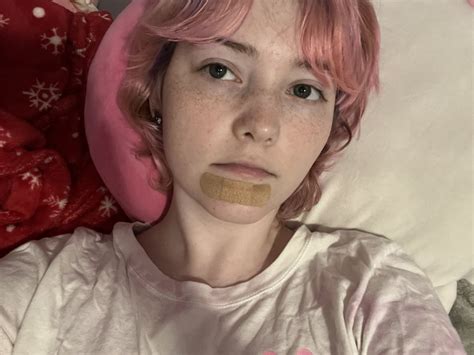 Lil Bbg🤍 On Twitter I Covered My Mosquito Bites Bc I Cant Fucking