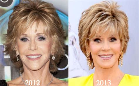 Jane Fonda Plastic Surgery Before and After Photos