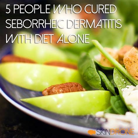 5 People Who Cured Seborrheic Dermatitis With Diet Alone Home