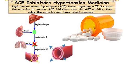 Ace Inhibitors Angiotensin Converting Enzyme Inhibitors