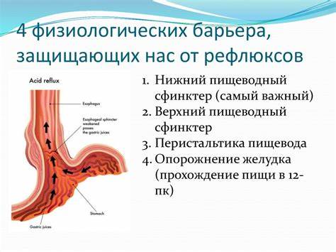 Ларингофарингеальный рефлюкс: клиника, диагностика, лечение - online Картинка - Ларингофарингеальный рефлюкс: клиника, диагностика, лечение - online