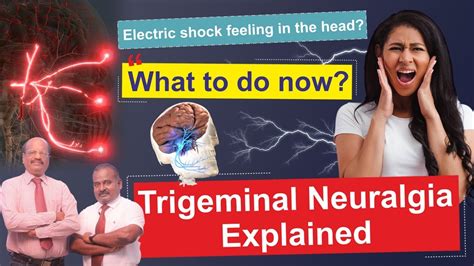 Electric Shock Feeling In The Head What To Do Now Trigeminal