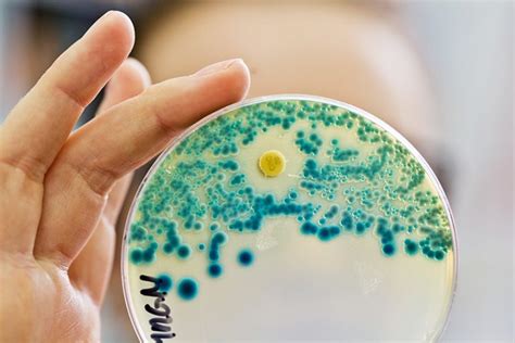 Der resistente Keim – Warum Antibiotika nicht immer wirken - IGPmagazin
