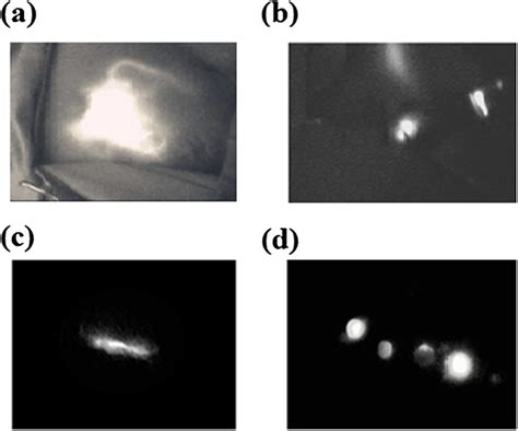 Sentinel Lymph Node Biopsy Slnb Using Indocyanine Green Fluorescence