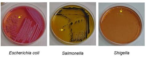 Brilliant Green Bile Broth Wikipedia - Salmonella-Shigella (SS) Agar: Composition, Principle, Procedure and