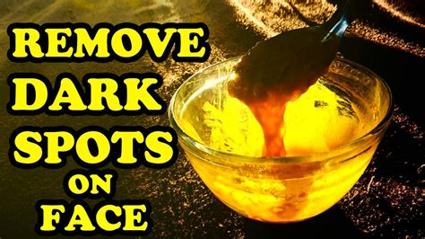 Home Remedies For Dark Spots On Face Natural Remedies To Remove Dark