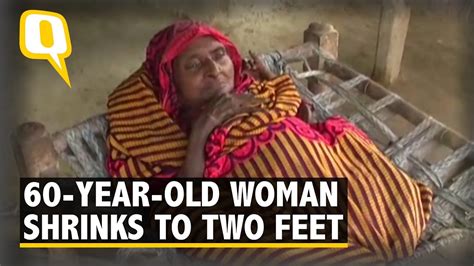 The Quint Mysterious Disease Shrinks Woman From Feet To Feet Tall YouTube