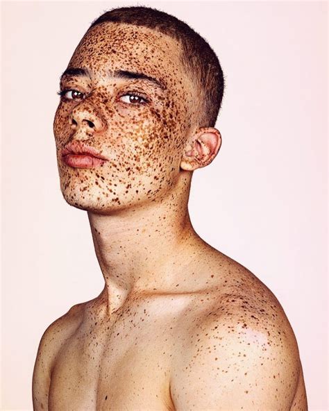 Stunning Beauty Photography Of Freckled Individuals By Brock Elbank