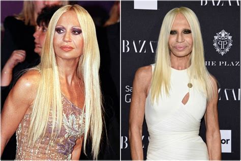 Shocking Celebrity Transformations Page Six