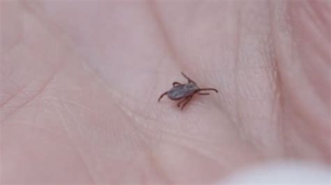 Itv West Country Lyme Disease News For Bristol And The West Country