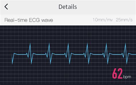 My heart skipped a beat when i saw that the doctor was calling with the results from the test. BEAT 20 High Precision ECG Heart Rate Monitor | Shanren