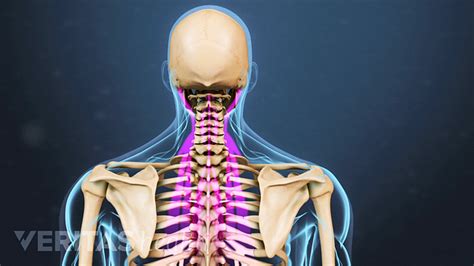 Neck Strain Symptoms Spine Health