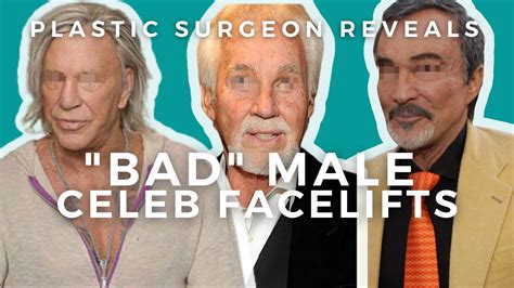 Mens Facelift Surgery Mickey Rourke Kenny Rogers Burt Reynolds Youtube