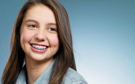 Beautiful Braces Ideas In Braces Braces Girls Brace Face