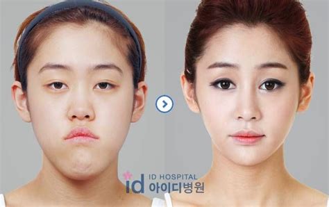 Chinese Graduates Are Having Cosmetic Surgery To Help Them Get Jobs Extreme Plastic Surgery