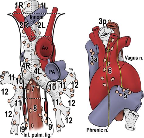 Current Status Of Mediastinal Lymph Node Dissection Versus Sampling In