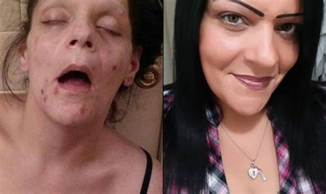 una exadicta recuperada publica fotos de su peor momento la heroína destrozó mi vida verne