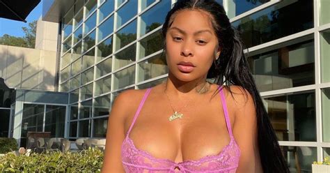 How Did Alexis Skyy Look Before Surgery Fans Are Not Shocked