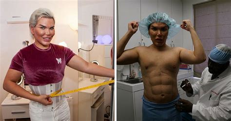 Human Ken Doll Reveals His New Look After Having Ribs Removed