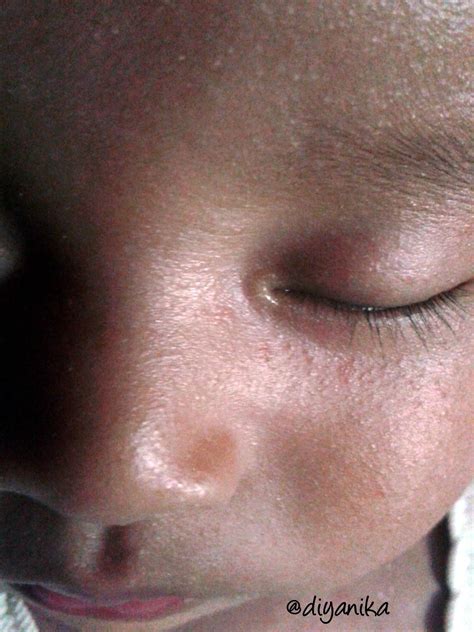 Diyanika Journal: Ini Cara Mengatasi Biang Keringat pada Bayi