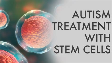 Autism Treatment With Stem Cells Stem Cell Therapy For Autism Stem