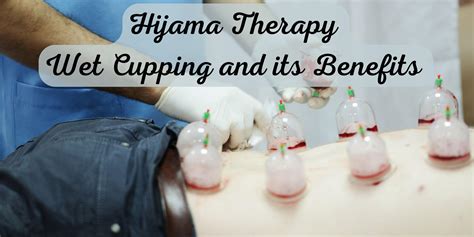 Hijama Therapy Wet Cupping And Its Benefits Yesmaam