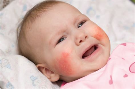 December 25th, 12:43 pm december 25th, 12:43 pm gading perkasa © disediakan oleh kompas.com dewi perssik sedang berbincang dengan deddy corbuzier. Ini Penyebab Biang Keringat pada Bayi