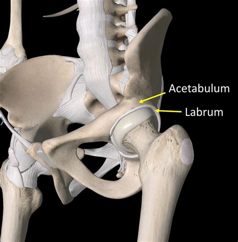 Esclerose No Teto Acetabular