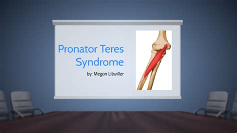 Pronator Teres Syndrome By Megan Litwiller