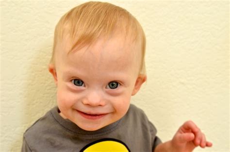 There is nothing you can do to prevent or avoid your child having down syndrome. Why Parenting Is The Best Paying Job In The World