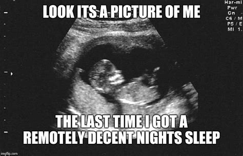 Image Tagged In Ultrasound Babby Imgflip
