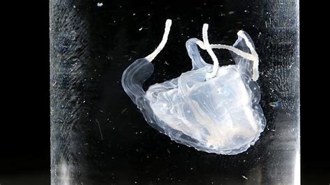 Stinger Expert Backs Jellyfish Theory Behind Tourists Deaths At