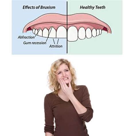 What Are The Signs And Symptoms Of Teeth Grinding