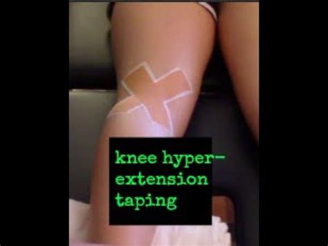 Knee Hyper Extension Taping Youtube